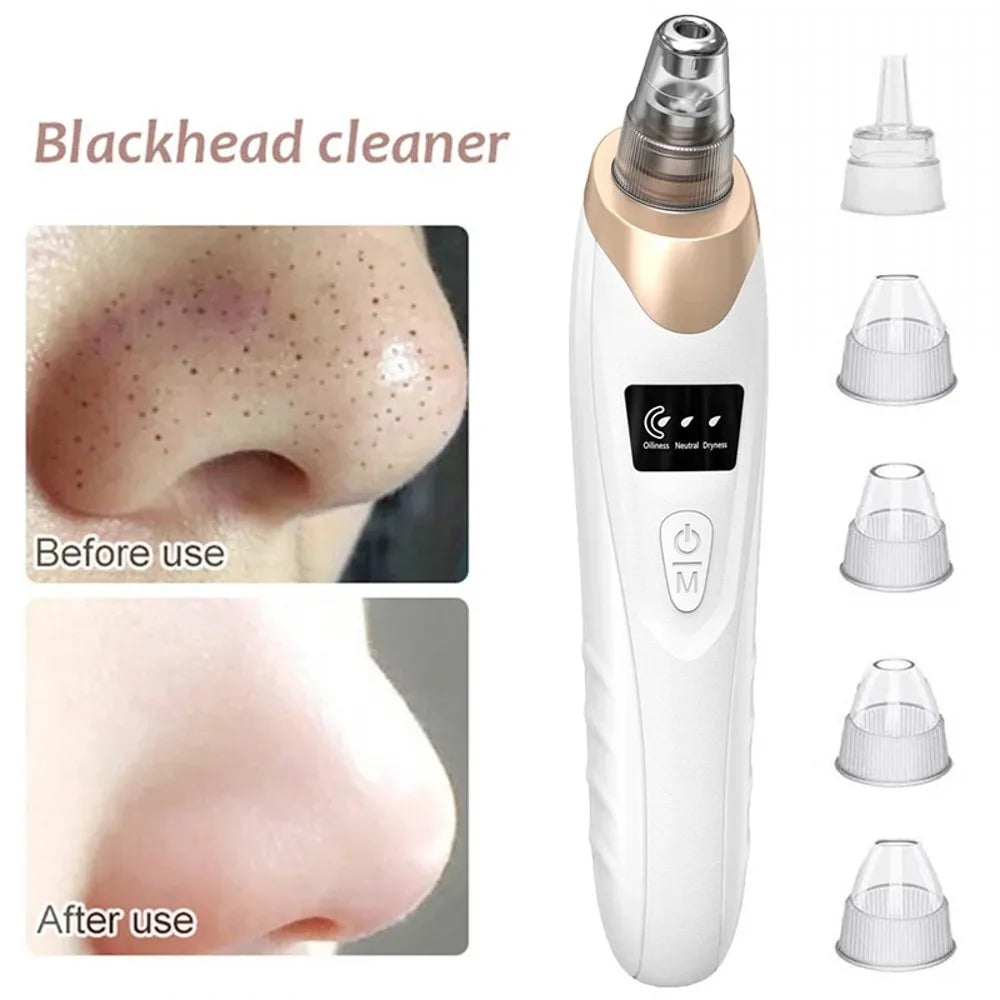 Zelixo Electric Blackhead Vacuum Remover — Facial Pore Cleanser Suction Machine