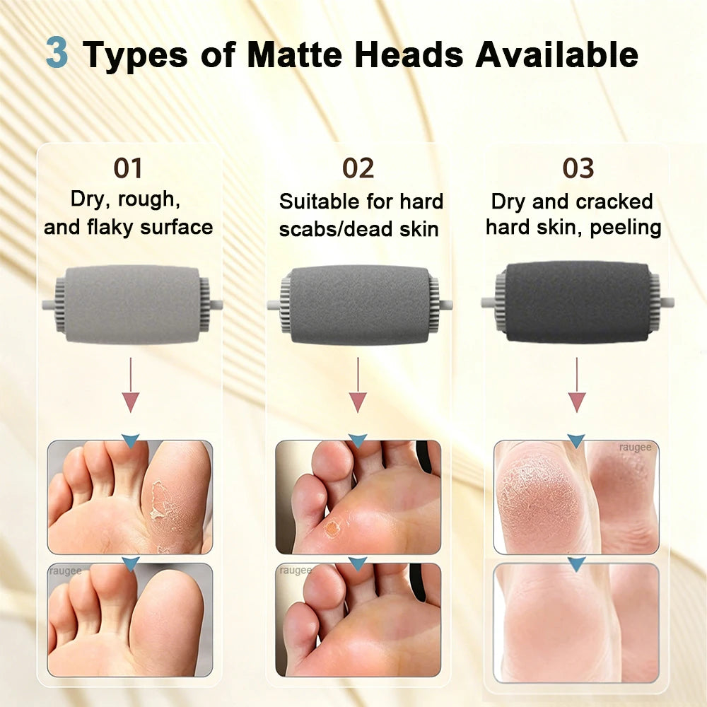 Zelixo Electric Foot File Callus Remover — Portable USB Rechargeable Pedicure Tool
