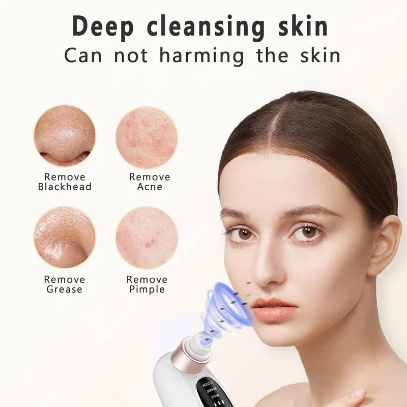 Zelixo Blackhead Remover Pore Vacuum — Water Cycle USB Rechargeable Pore Cleaner