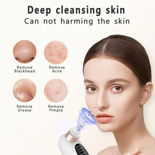 Zelixo Blackhead Remover Pore Vacuum — Water Cycle USB Rechargeable Pore Cleaner