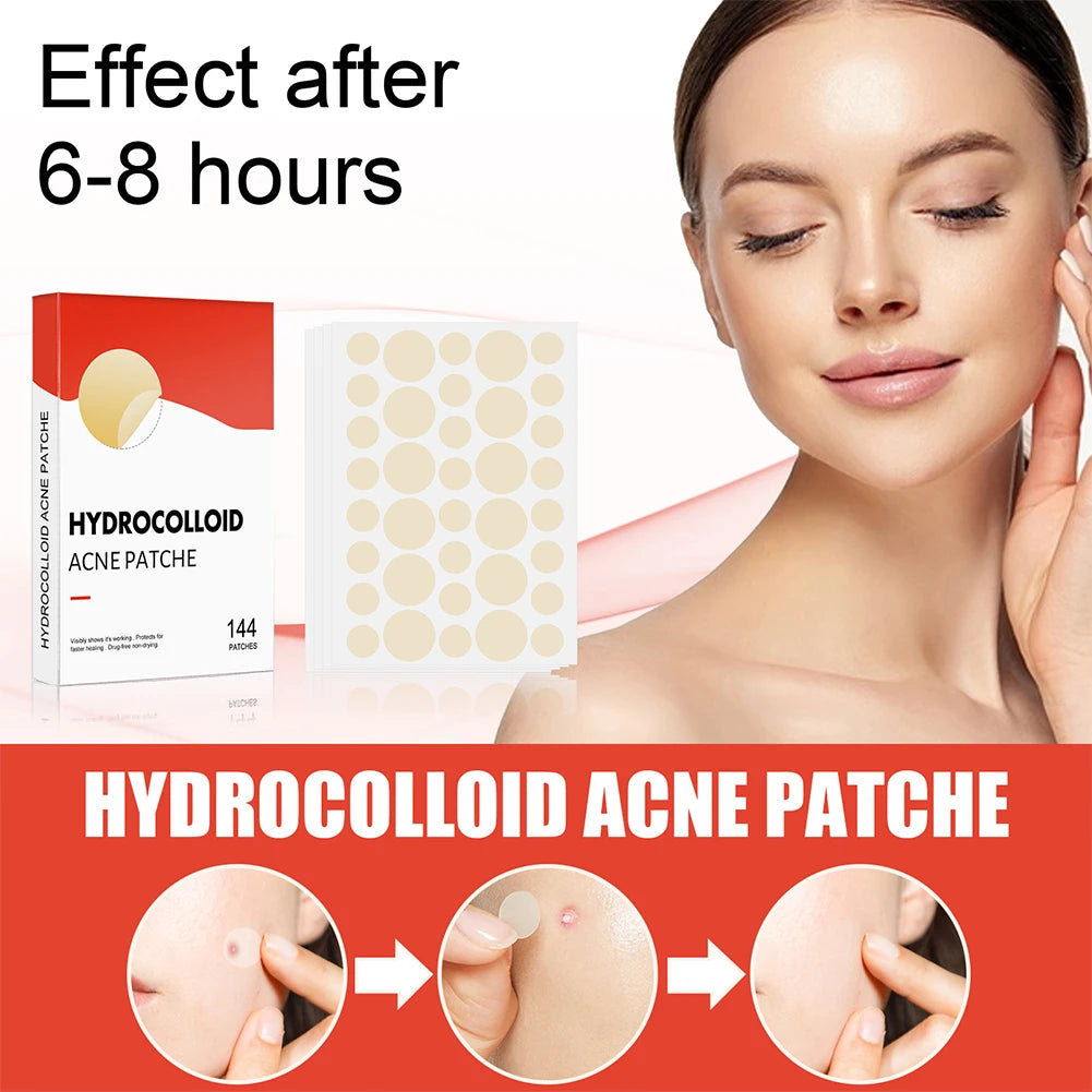 Zelixo Acne Pimple Patch — 144pcs Invisible Healing Spot Sticker for Face