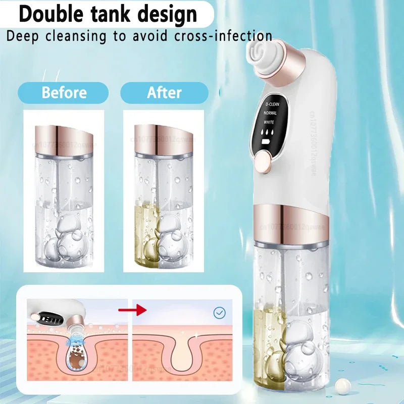 Zelixo Blackhead Remover Pore Vacuum — Water Cycle USB Rechargeable Pore Cleaner