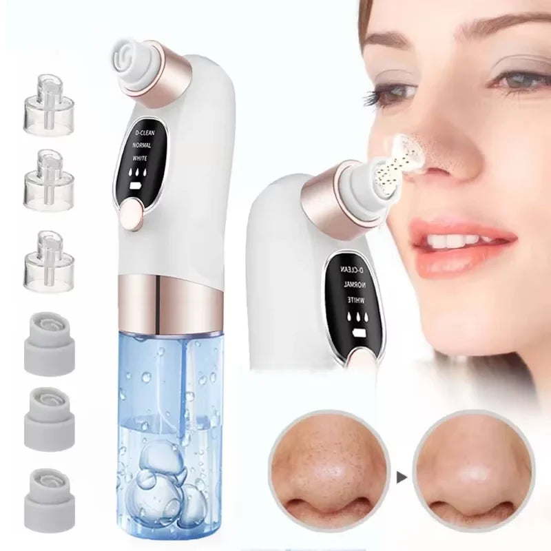 Zelixo Blackhead Remover Pore Vacuum — Water Cycle USB Rechargeable Pore Cleaner