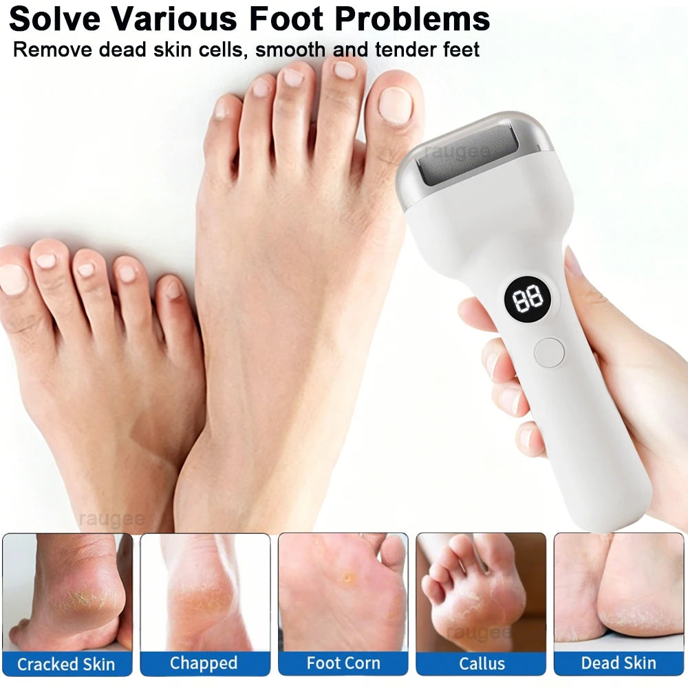 Zelixo Electric Foot File Callus Remover — Portable USB Rechargeable Pedicure Tool