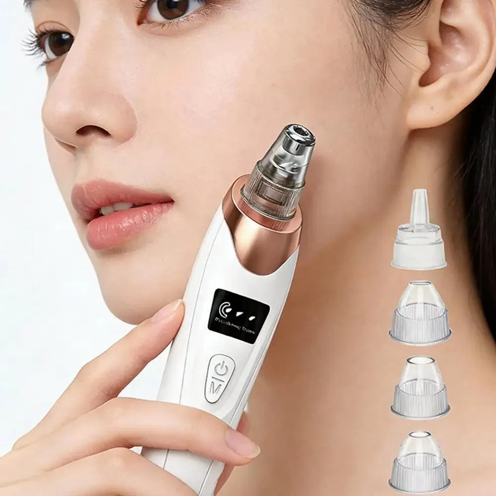 Zelixo Electric Blackhead Vacuum Remover — Facial Pore Cleanser Suction Machine