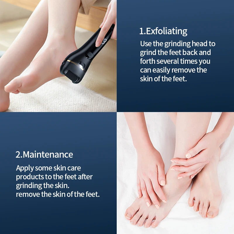 Zelixo Electric Foot Grinder — USB Rechargeable Callus Remover Pedicure Tool