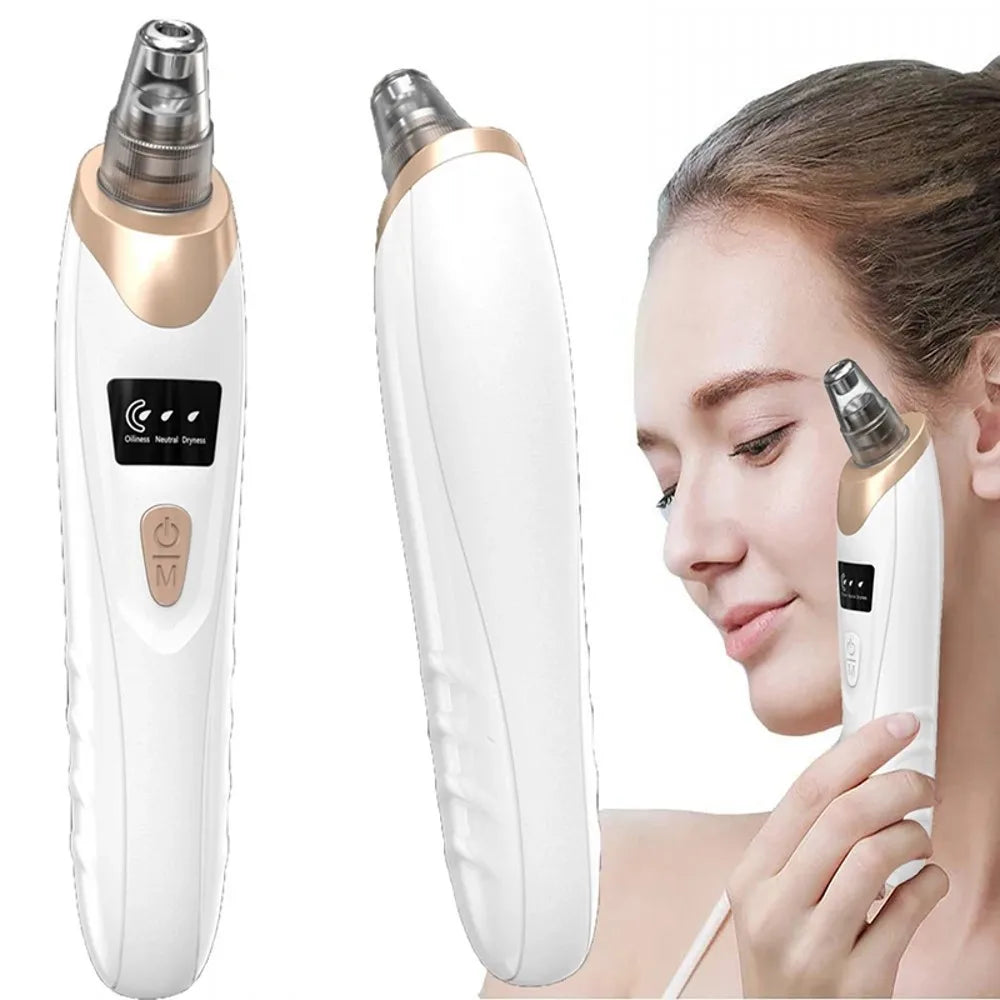 Zelixo Electric Blackhead Vacuum Remover — Facial Pore Cleanser Suction Machine