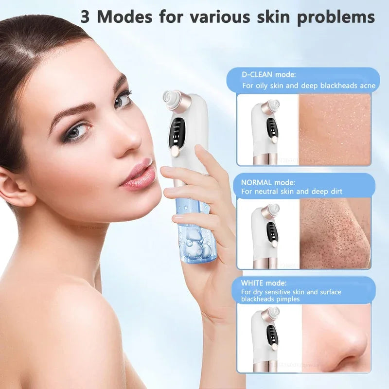 Zelixo Blackhead Remover Pore Vacuum — Water Cycle USB Rechargeable Pore Cleaner