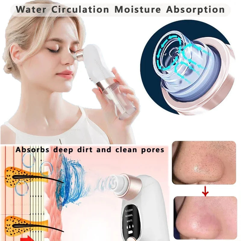Zelixo Blackhead Remover Pore Vacuum — Water Cycle USB Rechargeable Pore Cleaner