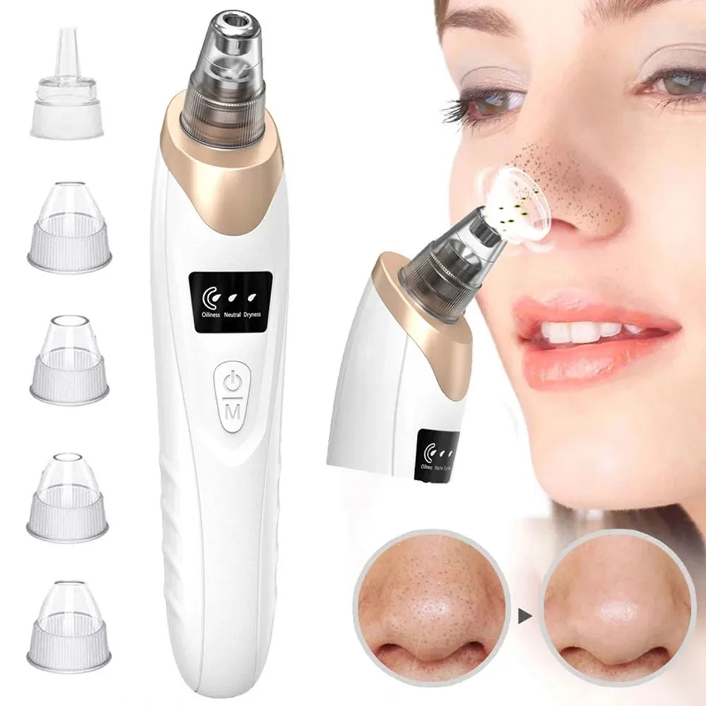 Zelixo Electric Blackhead Vacuum Remover — Facial Pore Cleanser Suction Machine