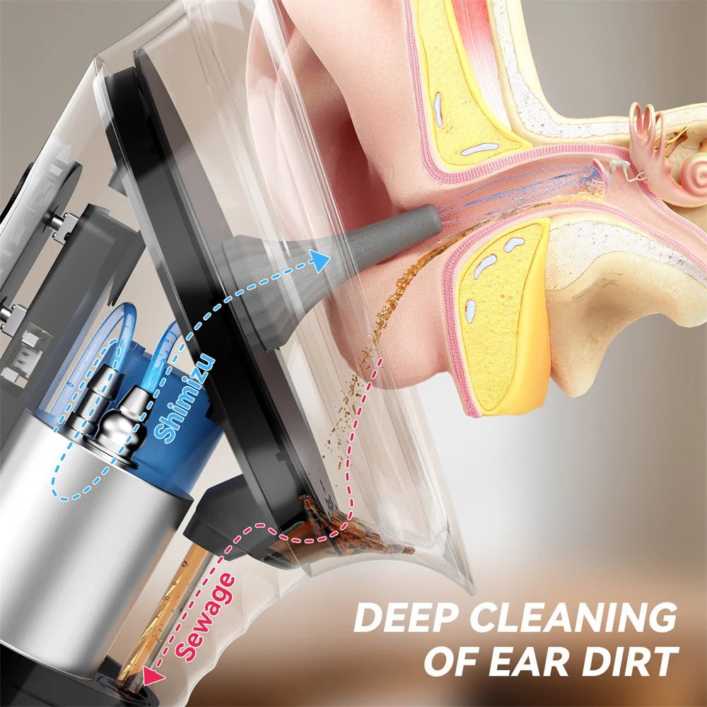 Upgraded Ear Wax Removal with Waste Water Tank Safety Ear Cleaner with Water Temperature Sensor Effective Ear Irrigation Kit - Zelixo.shop
